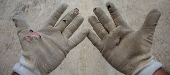 Image of a construction worker's hands with torn work gloves. Reference to strenuous work
