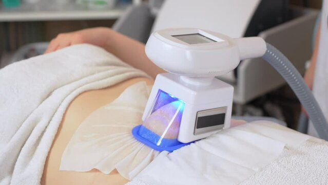 Close up of hardware cosmetology. Cryolipolysis body contouring procedure. Anti aging rejuvenation. Cryolipolysis fat treatment procedure. Anti cellulite program form correction