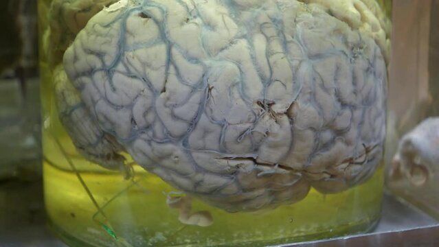 Real human brain, grey matter. Human brain in glass jar with formaldehyde for medical research. Anatomy of brain, grey substance, cortical grey