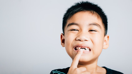Cute boy widely smiling points to growing molar gap. joyful portrait capturing significant phase of...