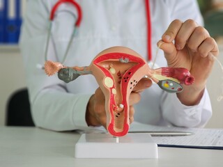 Anatomical structure of female uterus with adhesive plasters on fallopian tubes
