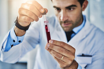 Man, science and blood sample in laboratory for study of disease, medical research and diagnostic...