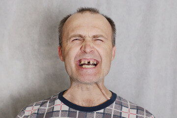 Portrait of a mentally abnormal man.
