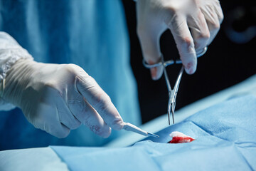 Detail shot of unrecognizable surgeon holding tools performing surgery in operating room copy space