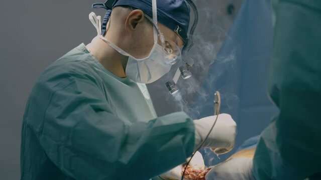 Doctor man physician practitioner surgeon medic in medical mask operating patient perform surgery electrocautery surgical operation neurosurgical modern innovation health medicine in hospital clinic