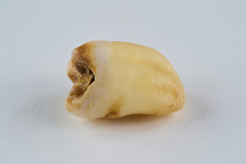 抜歯された歯と白背景