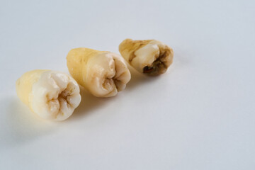 抜歯された歯と白背景