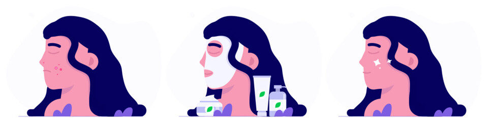  Face with pimples. Acne, skin care, skin health and dermatology, Face mask  concept. Vector flat illustration.