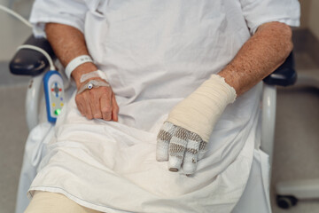 Burns Patient Recovery: Bandaged Hands in Hospital Care
