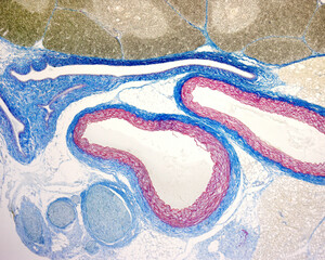 Elastic artery