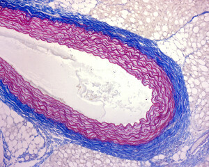 Elastic artery