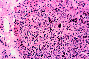 Carotid body