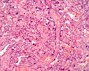 Human placenta. Chorionic villi