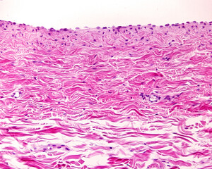 Vein wall layers