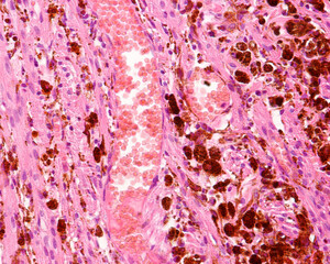 Eye.  Choroid pigment cells