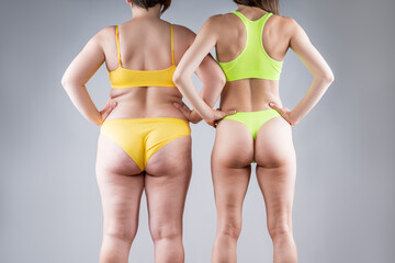 Before after weight loss, fat and thin women with flabby and muscular back, hips and buttocks on gray background, plastic surgery concept