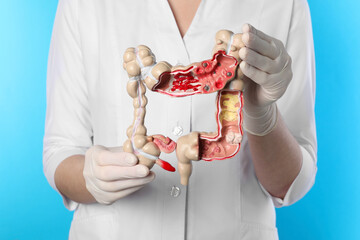 Doctor with model of large intestine on light blue background, closeup