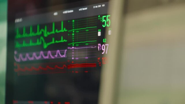 Monitoring of patient during operation