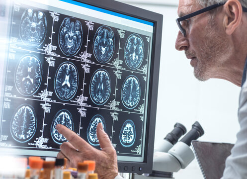 Scientist doing research on MRI report in laboratory