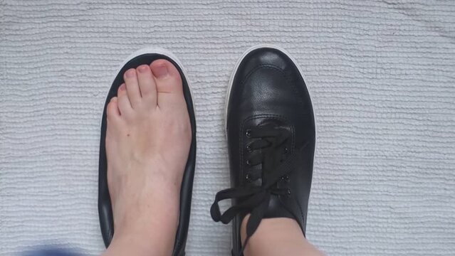 Foot deforming shoes. Incorrect anatomical shoes with flat soles. Small insole size, which causes foot pain. Cause of valgus, calluses, ingrown toenails