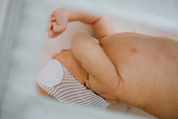 Neonatal jaundice under blue light