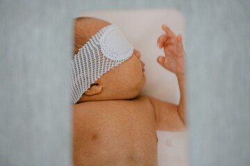 Neonatal jaundice under blue light