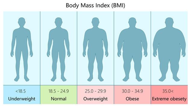 Illustrative chart showing different BMI categories underweight to extreme obesity body mass index values diagram hand drawn schematic raster illustration. Medical science educational illustration