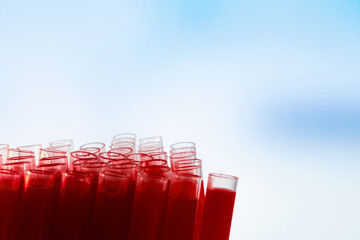 Laboratory test tubes with blood tests on a blue background