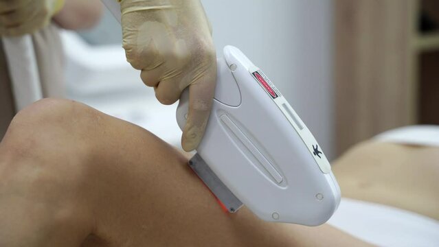Leg procedure. A professional dermatologist uses modern technology for laser hair removal. The lady undergoes a rejuvenating treatment, enhancing skin health in a well-equipped beauty clinic