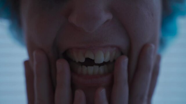 Injured woman with broken tooth crying in hospital clothes in emergency room. Female with chipped tooth weeps at clinic. Woman accident victim in hospital is scared and hysterical. Dental trauma. 