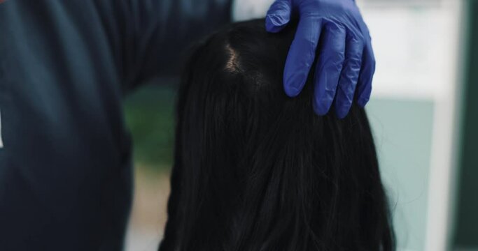 Doctor hands, patient and check scalp for healthcare, dandruff or lice problem and consultation in clinic. Trichologist, gloves and exam for hair loss with alopecia diagnosis, textures and wellness
