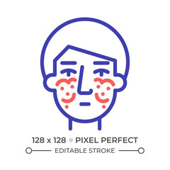 Lupus rash two color line icon. Erythema chronic illness. Life expectancy disorder. Immune system treatment bicolor outline symbol. Duotone linear pictogram. Isolated illustration. Editable stroke