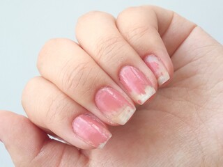 Worn-out nail polish. The pink polish has worn off the nails. Ruined manicure close-up, on a white background. Ruined fingernails.