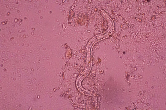 View in microscopic Strongyloides stercoralis or threadworm in human stool.Parasite infection.Medical background analyze by microscope, original magnification 400x