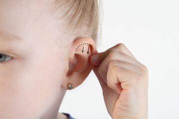 A girl holds her ear with her hand on a white background. The concept of changing ear shapes in...