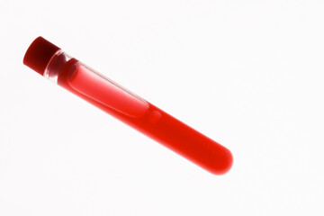 Laboratory test tube with lid and blood samples on light background