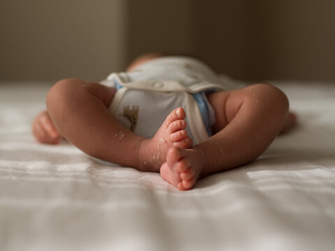 Crop baby with peeling skin sleeping on bed