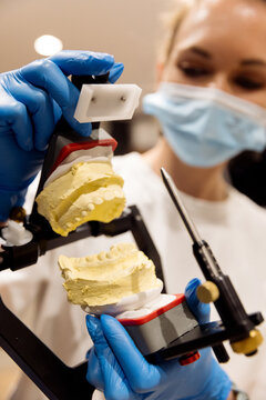 dental assistant holding dental casts in hands
