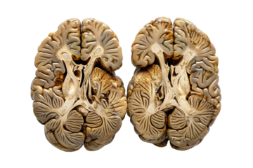 Human Brain Cross Section - Anatomical Detail