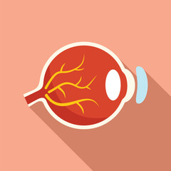 Illustration featuring the anatomical structure of a human eye undergoing a laser vision correction procedure