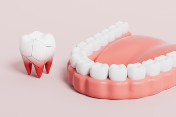 3d rendering tooth medical picture