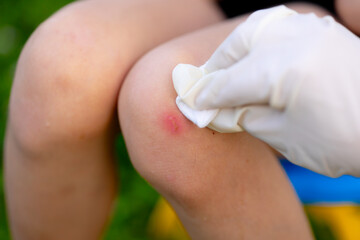 a modern mother treats a wound on her daughter's injured knee. Family life at home and playing in the yard. Helping and caring for a sick girl.