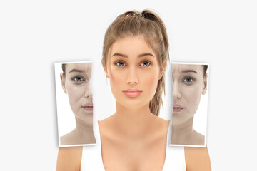 Effects of ageing,Frown/scowl lines ,Nasolabial folds,Neck ,Under eye circles,neck lines. Plastic...