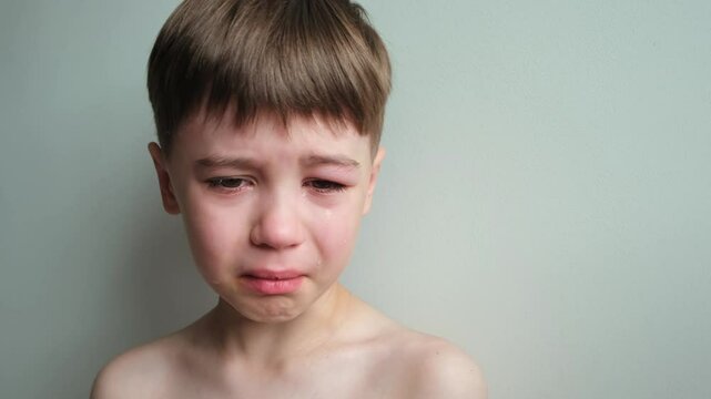 Dramatic portrait of a crying 7 year oldboy. Tears flow from the eyes. The upset child. A swollen eye hurts due to a blow or insect bite. Sorrow. Children violence. Stress concept. Kids hysteria. 4K