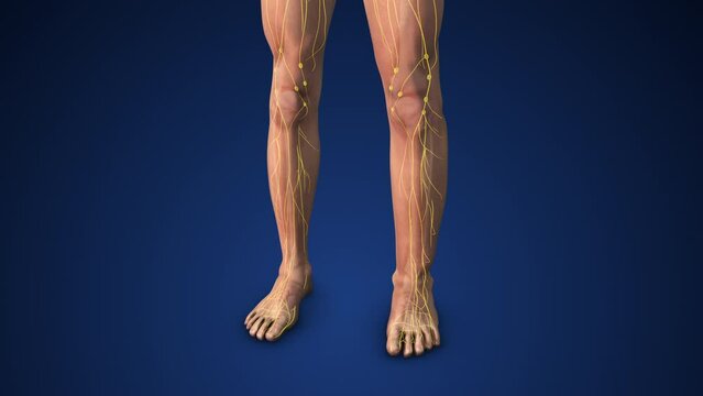 Medical animation of lymphedema in the legs