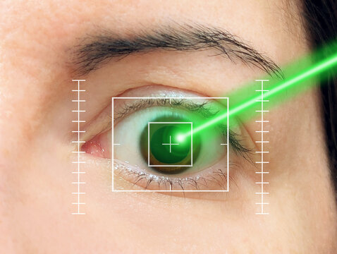 Close-up of brown eye with digital guides treated with green argon laser beam surgery process for retinal vision disease, diabetic retinopathy, retinovascular visual illness problems and glaucoma. 