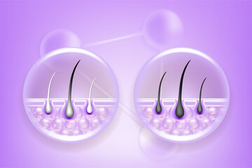 Hyaluronic acid and Niacinamide before and after gray hair and skin solutions ad, purple collagen serum drops into skin cell with cosmetic advertising background ready to use, illustration vector.