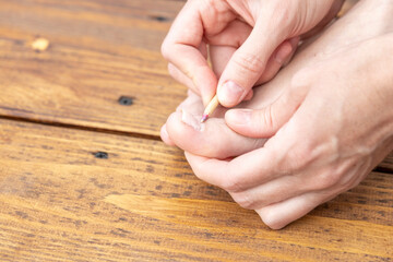 A person is using a pencil to scratch their foot