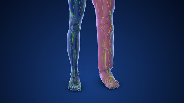 Medical animation depicting limb lymphedema