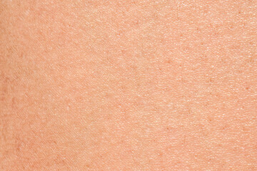 Human skin